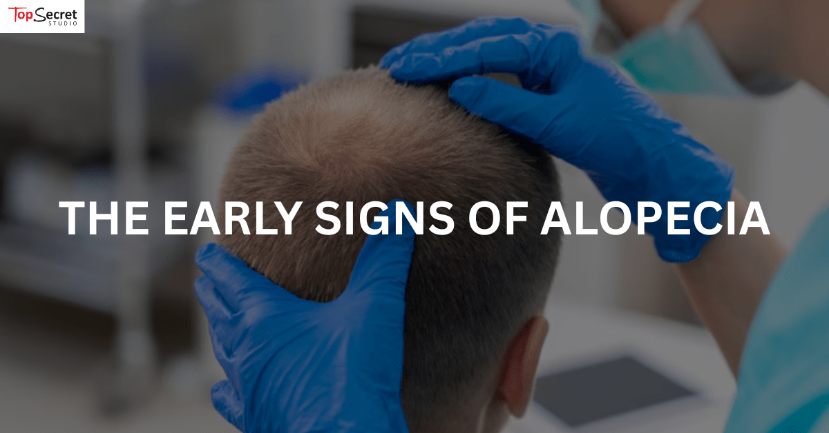 Man suffering from alopecia and a trichologist is treating him.