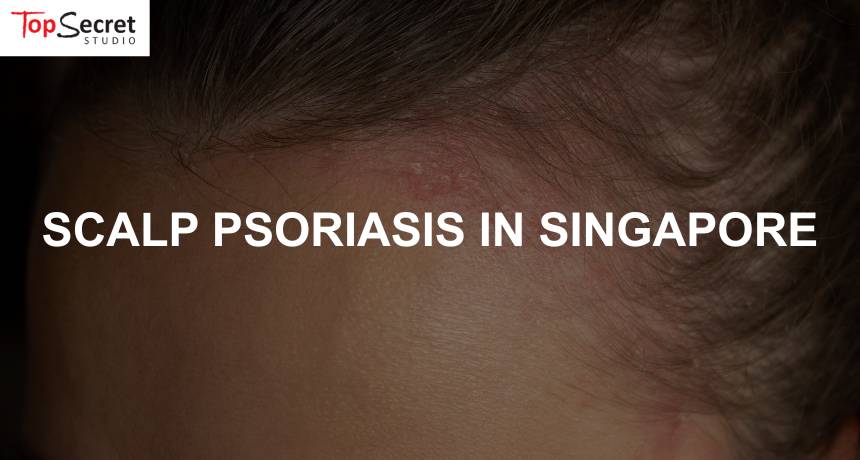 singapore woman facing scalp psoriasis