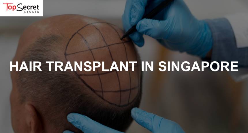 singapore man getting a hair transplant and in the process of it